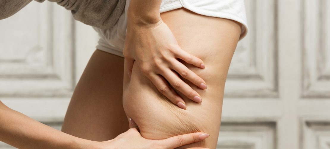 jambes lourdes